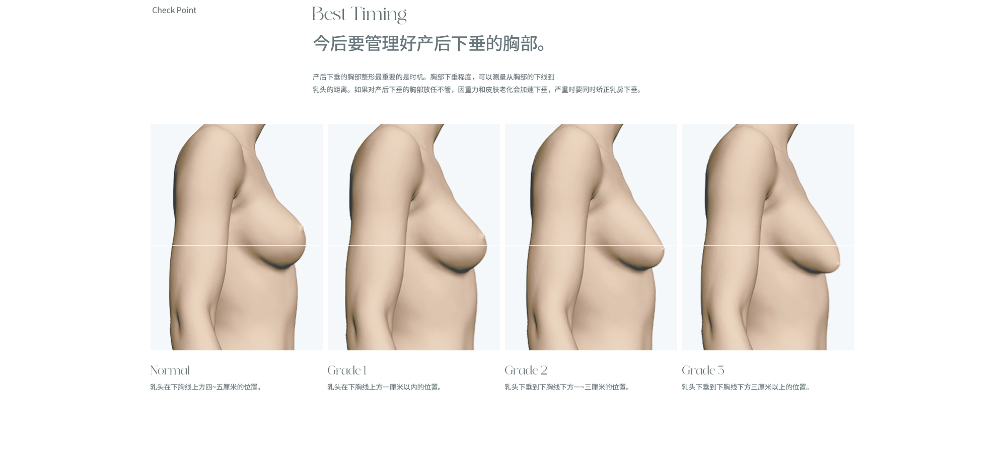 产后胸部整形